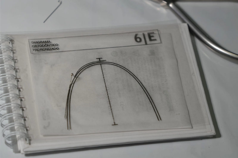 Снимка на Практически курс: Огъване на ортодонтски дъги, контрол на биомеханиката и диаграмиране