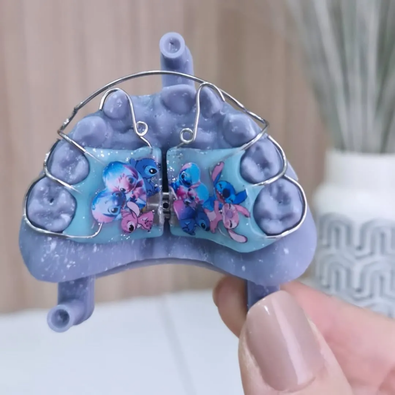 Снимка на Темпоромандибуларни смущения (TMD), бруксизъм и терапия с оклузални шини