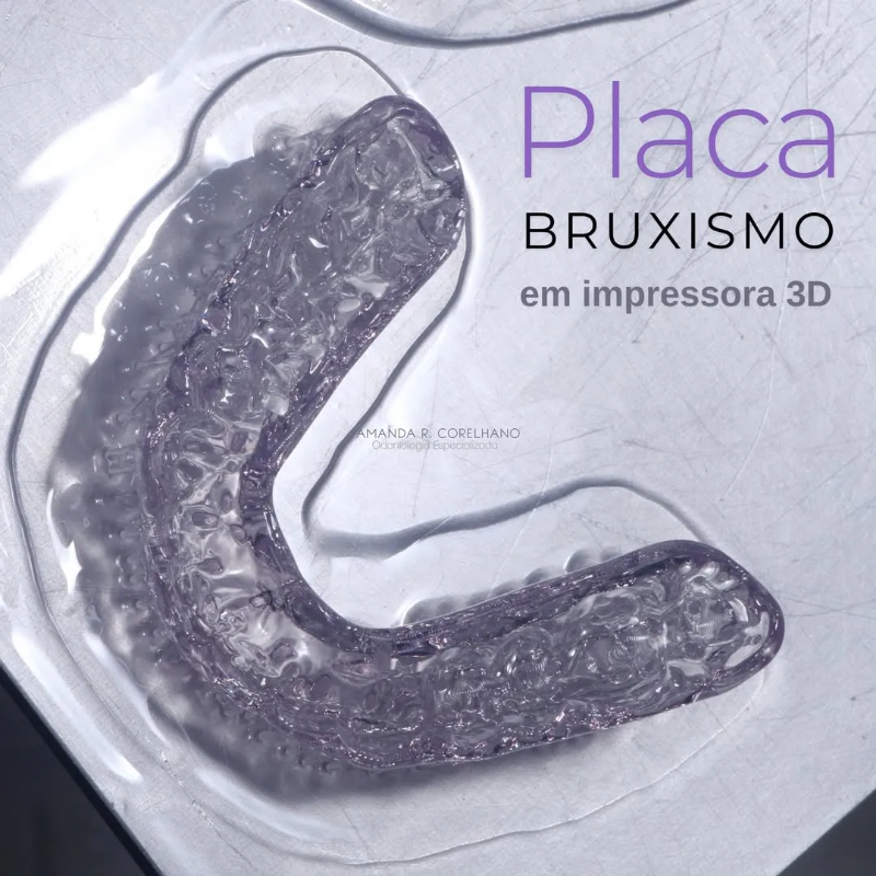 Снимка на Темпоромандибуларни смущения (TMD), бруксизъм и терапия с оклузални шини