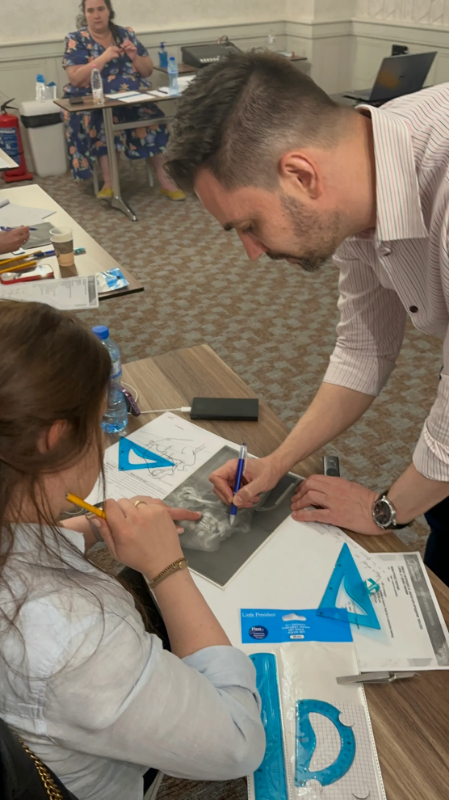 Снимка на Лечение на Клас II малоклузия – съвременни подходи от детска до зряла възраст