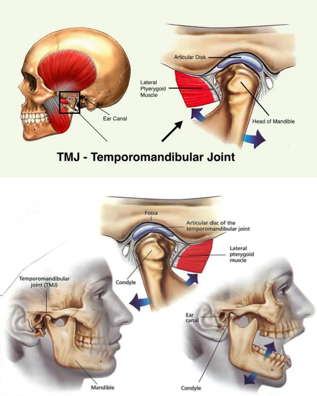 Снимка на Темпоромандибуларни смущения (TMD), бруксизъм и терапия с оклузални шини