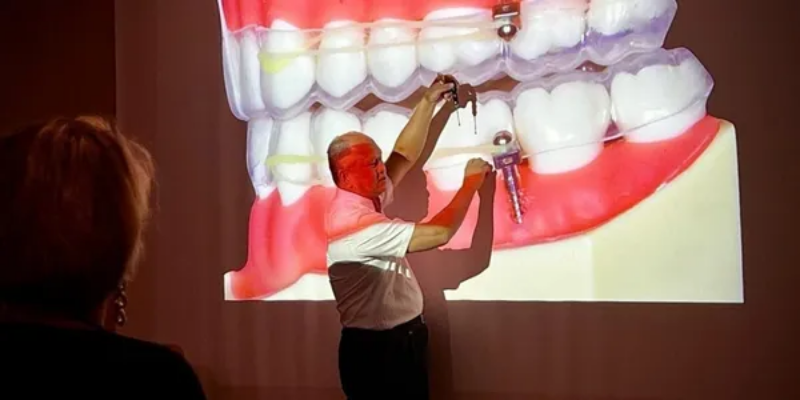 Снимка на Основи на биомеханиката в ортодонтията. Концепции на пасивните самолигиращи брекети.